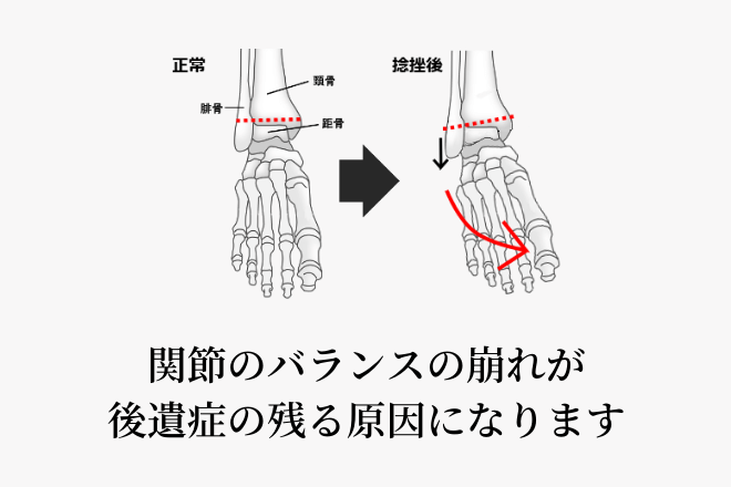 関節のバランスの崩れが後遺症の残る原因になります