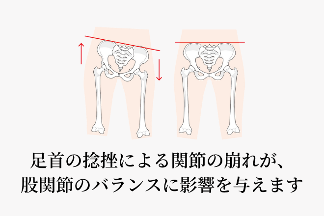 捻挫後のバランスの崩れが重心や全身の歪みに繋がります