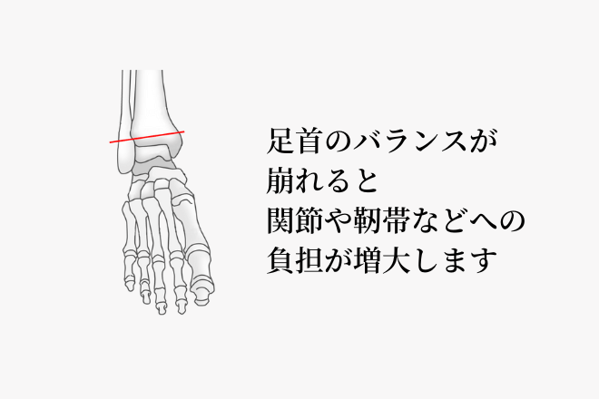 足首のバランスが崩れると、関節や靭帯などへの負担が増大します