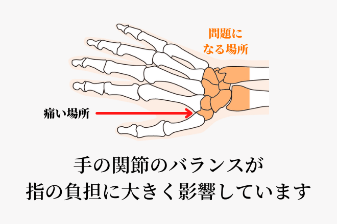 母指ＣＭ関節症は関節のバランスを崩してしまうことが主な原因です