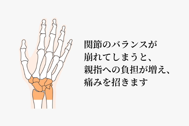 関節のバランスが崩れてしまう、親指への負担が増え、痛みを招きます