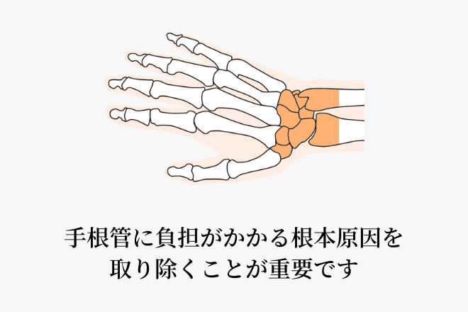 手根管に負担がかかる根本原因を取り除くことが重要です