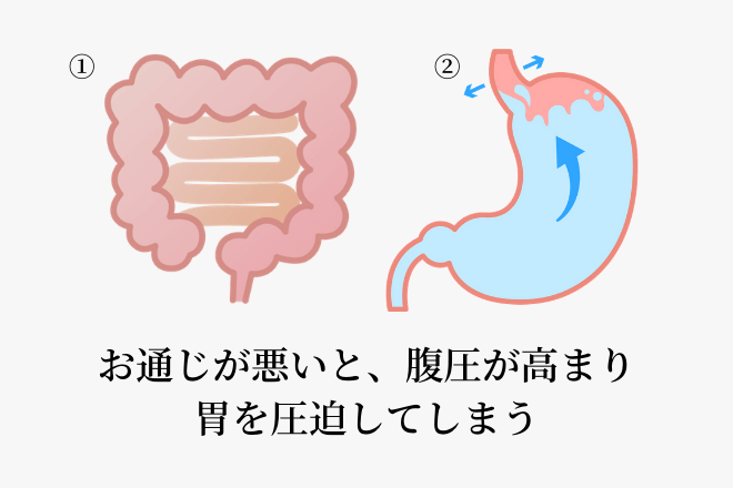 お通じが悪いと、腹圧が高まり胃を圧迫してしまう