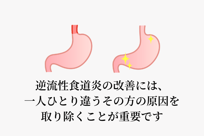 逆流性食道炎の改善には、一人ひとり違うその方の原因を取り除くことが重要です