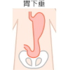 胃下垂に逆立ちは本当に効果があるのか 大阪の整体 創輝鍼灸整骨院