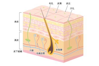 ニキビが起こる肌の状態