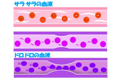 水不足でドロドロになった血液