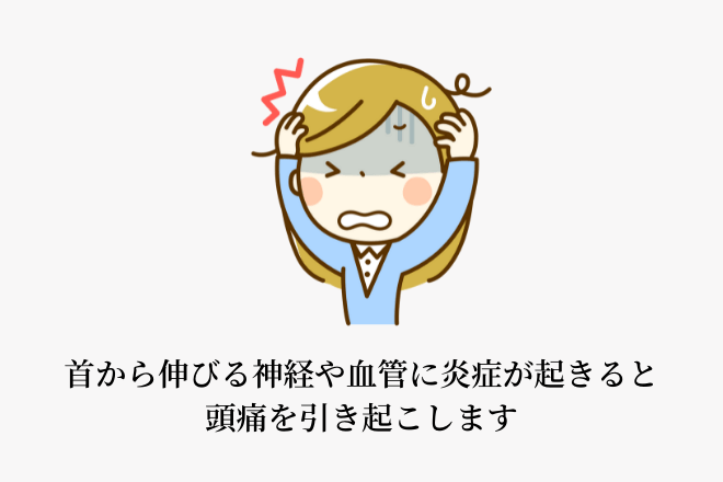 首から伸びる神経や血管に炎症が起きると頭痛を引き起こします