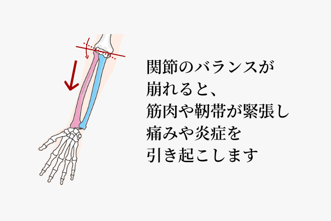 姿勢が悪く、肩が内巻きになると肘への負担が大きくなります