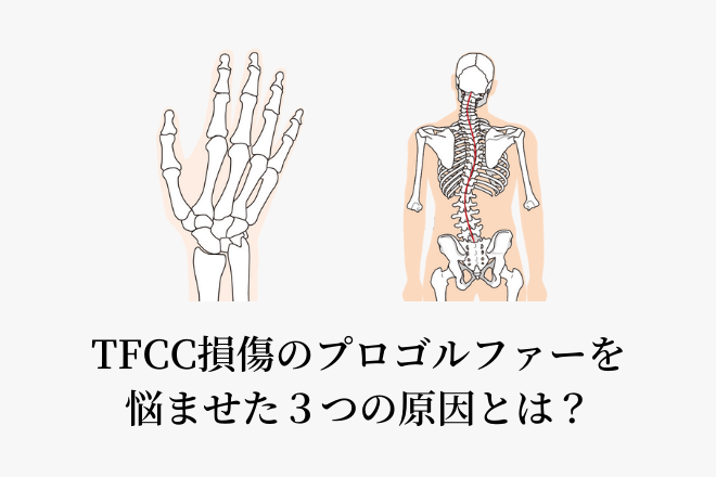 TFCC損傷のプロゴルファーを悩ませた３つの原因とは？