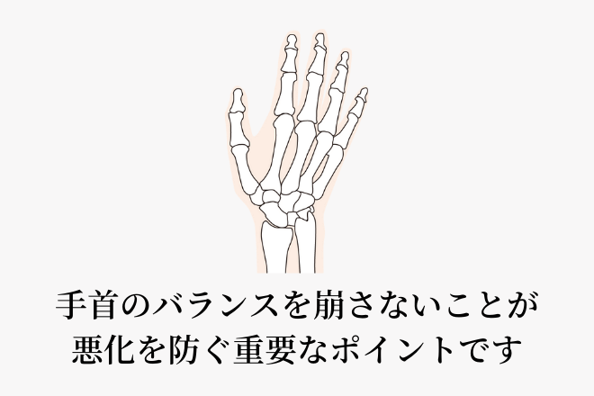 手首のバランスを崩さないことが悪化を防ぐ重要なポイントです