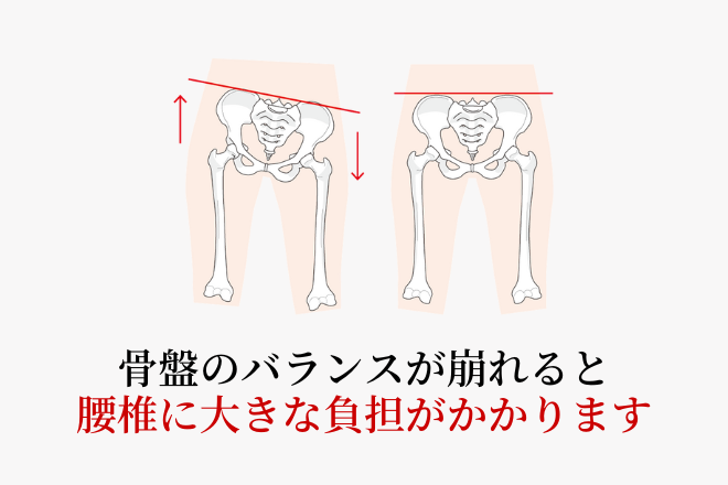 骨盤のバランスが崩れると腰椎に大きな負担がかかります