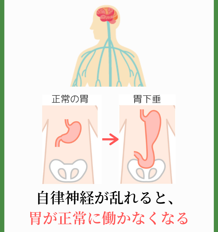 原因その２．自律神経の乱れによって、胃を支えている筋肉の働きが落ちるから