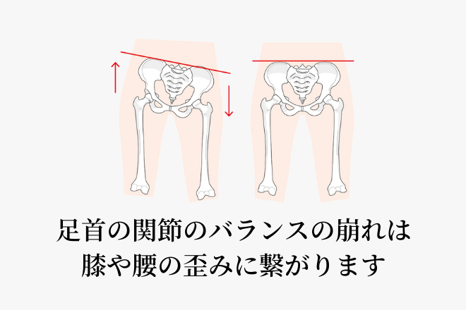 足首の関節のバランスの崩れは、膝や腰の歪みに繋がります