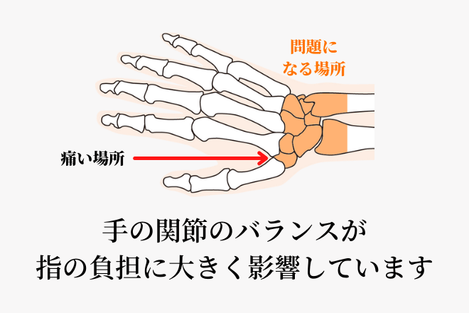 手の関節のバランスが指の負担に大きく影響しています
