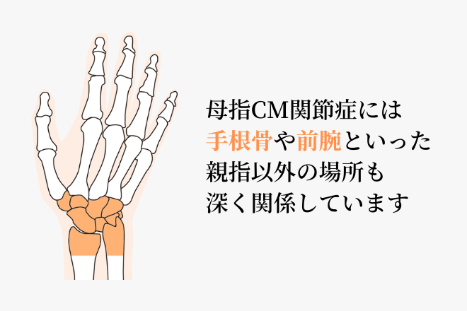 母指CM関節症には手根骨や前腕といった親指以外の場所も深く関係しています