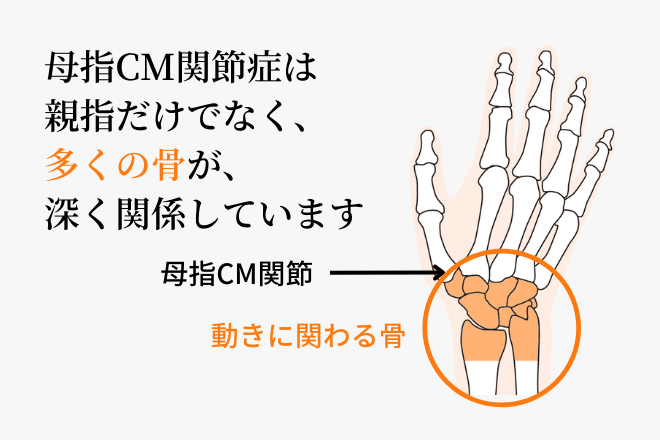 母指CM関節症には手根骨や前腕といった親指以外の場所も深く関係しています