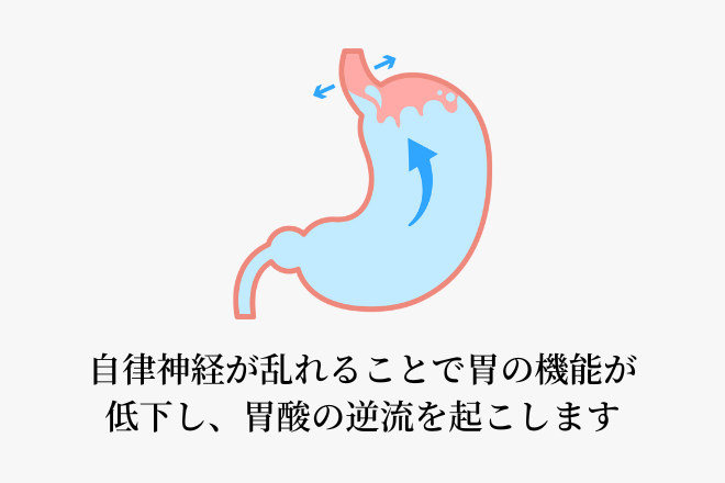 自律神経が乱れることで胃の機能が低下し、胃酸の逆流を起こします