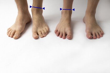 二人の足首のバランスの比較画像