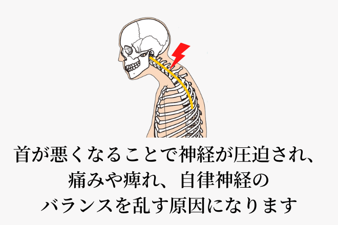 首が悪くなることで神経が圧迫され、痛みや痺れ、自律神経のバランスを乱す原因になります