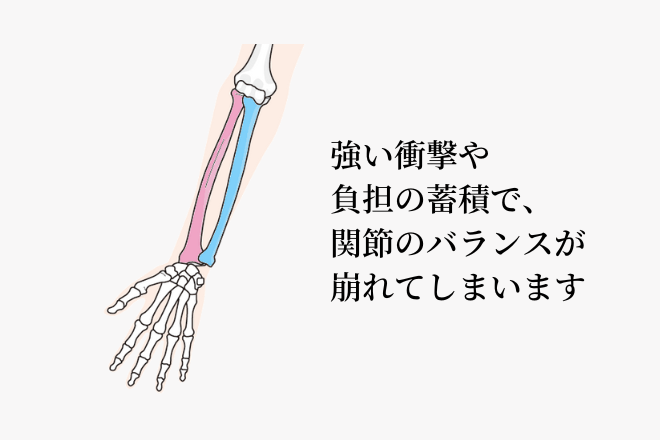 強い衝撃や負担の蓄積で、関節のバランスが崩れてしまいます