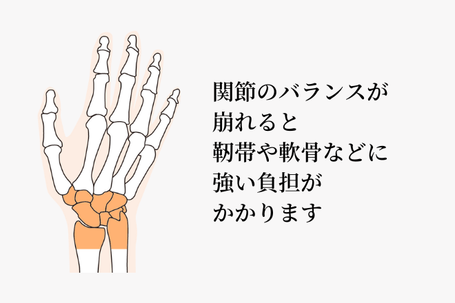 関節のバランスが崩れると靭帯や軟骨などに強い負担がかかります