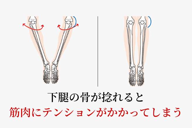 足首の関節のバランスのイラスト。下腿の骨が捻れると筋肉にテンションがかかってしまう