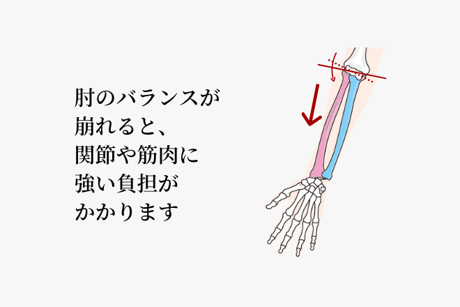 肘のバランスが崩れると、関節や筋肉に強い負担がかかります